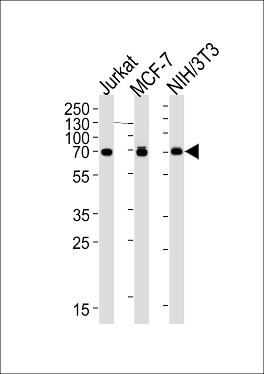 RPS6KB2 / S6K2 Antibody - RPS6KB2 Antibody western blot of Jurkat, MCF-7, mouse NIH/3T3 cell lysates (35 ug/lane). This demonstrates that the RPS6KB2 antibody detected RPS6KB2 protein (arrow).