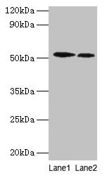RPS6KB2 / S6K2 Antibody - Western blot All lanes: Ribosomal protein S6 kinase beta-2 antibody at 2µg/ml Lane 1: EC109 whole cell lysate Lane 2: 293T whole cell lysate Secondary Goat polyclonal to rabbit IgG at 1/15000 dilution Predicted band size: 54, 17 kDa Observed band size: 54 kDa