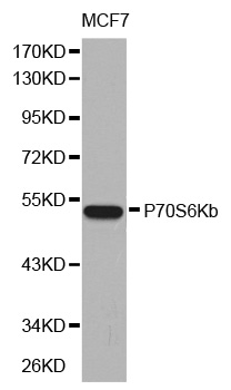 RPS6KB2 / S6K2 Antibody - Western blot analysis of extracts of MCF7 cell line, using P70S6Kb antibody.