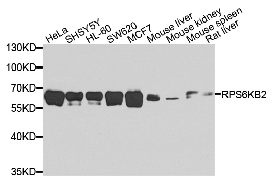 RPS6KB2 / S6K2 Antibody - Western blot analysis of extracts of various cell lines, using RPS6KB2 antibody at 1:1000 dilution. The secondary antibody used was an HRP Goat Anti-Rabbit IgG (H+L) at 1:10000 dilution. Lysates were loaded 25ug per lane and 3% nonfat dry milk in TBST was used for blocking. An ECL Kit was used for detection and the exposure time was 60s.