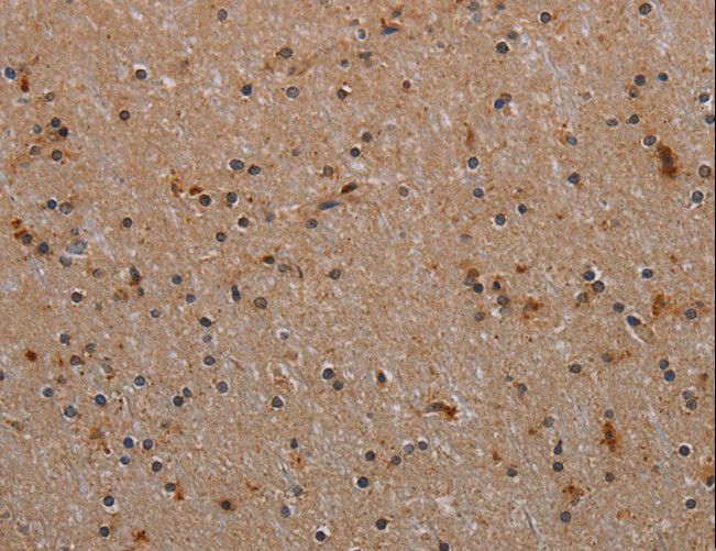 RPS6KB2 / S6K2 Antibody - Immunohistochemistry of paraffin-embedded Human brain using RPS6KB2 Polyclonal Antibody at dilution of 1:40.