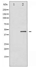 RPS6KB2 / S6K2 Antibody - Western blot of p70 S6 Kinase beta expression in 293 whole cell lysates,The lane on the left is treated with the antigen-specific peptide.