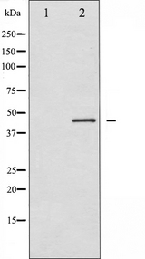 RPS6KB2 / S6K2 Antibody - Western blot analysis of p70 S6 Kinase beta expression in 293 whole cells lysates. The lane on the left is treated with the antigen-specific peptide.