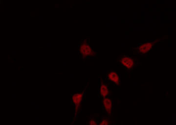 RPS6KB2 / S6K2 Antibody - Staining HeLa cells by IF/ICC. The samples were fixed with PFA and permeabilized in 0.1% Triton X-100, then blocked in 10% serum for 45 min at 25°C. The primary antibody was diluted at 1:200 and incubated with the sample for 1 hour at 37°C. An Alexa Fluor 594 conjugated goat anti-rabbit IgG (H+L) Ab, diluted at 1/600, was used as the secondary antibody.