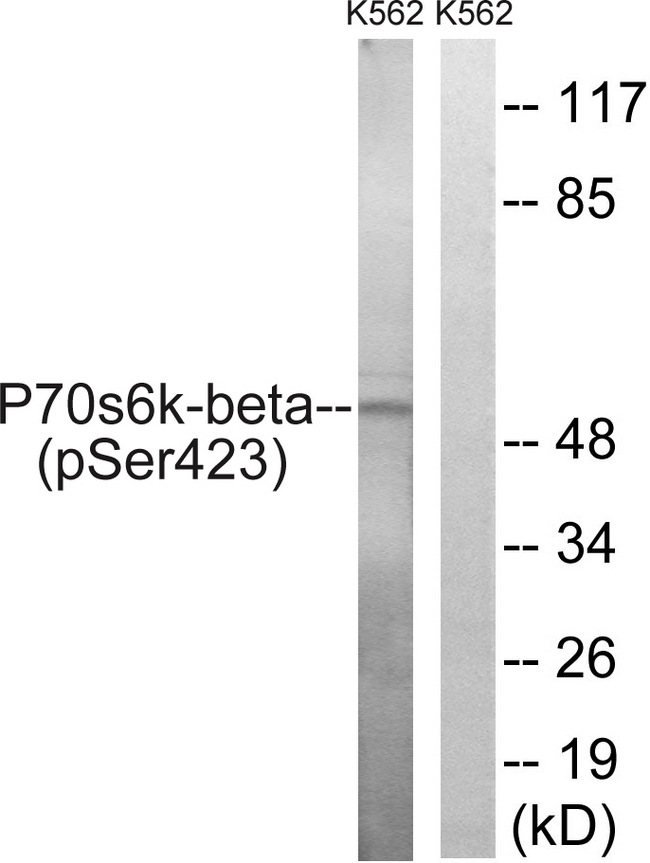 RPS6KB2 / S6K2 Antibody - Western blot analysis of lysates from K562 cells treated with EGF 200ng/ml 5', using p70 S6 Kinase beta (Phospho-Ser423) Antibody. The lane on the right is blocked with the phospho peptide.
