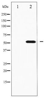 RPS6KB2 / S6K2 Antibody - Western blot of p70 S6 Kinase beta phosphorylation expression in EGF treated K562 whole cell lysates,The lane on the left is treated with the antigen-specific peptide.