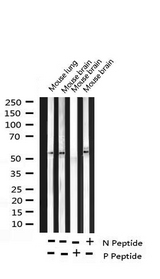RPS6KB2 / S6K2 Antibody - Western blot analysis of Phospho-p70 S6 Kinase beta (Ser423) expression in various lysates