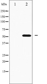 RPS6KB2 / S6K2 Antibody - Western blot analysis of p70 S6 Kinase beta phosphorylation expression in EGF treated K562 whole cells lysates. The lane on the left is treated with the antigen-specific peptide.
