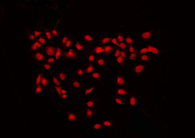 RPS6KB2 / S6K2 Antibody - Staining K562 cells by IF/ICC. The samples were fixed with PFA and permeabilized in 0.1% Triton X-100, then blocked in 10% serum for 45 min at 25°C. The primary antibody was diluted at 1:200 and incubated with the sample for 1 hour at 37°C. An Alexa Fluor 594 conjugated goat anti-rabbit IgG (H+L) Ab, diluted at 1/600, was used as the secondary antibody.