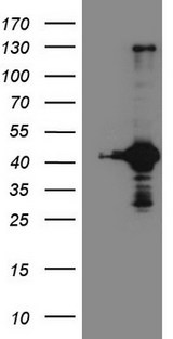 RPS6KC1 Antibody - HEK293T cells were transfected with the pCMV6-ENTRY control. (Left lane) or pCMV6-ENTRY RPS6KC1. (Right lane) cDNA for 48 hrs and lysed. Equivalent amounts of cell lysates. (5 ug per lane) were separated by SDS-PAGE and immunoblotted with anti-RPS6KC1. (1:2000)