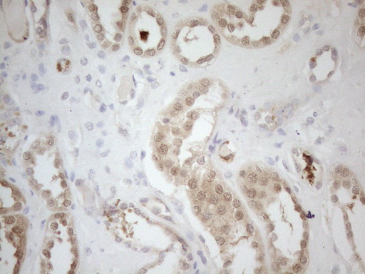 RPS6KC1 Antibody - Immunohistochemical staining of paraffin-embedded Human Kidney tissue using anti-RPS6KC1 mouse monoclonal antibody. (Heat-induced epitope retrieval by 1mM EDTA in 10mM Tris buffer. (pH8.5) at 120°C for 3 min. (1:150)