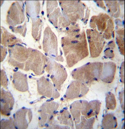 RPS6KC1 Antibody - RPS6KC1 Antibody immunohistochemistry of formalin-fixed and paraffin-embedded human skeletal muscle followed by peroxidase-conjugated secondary antibody and DAB staining.