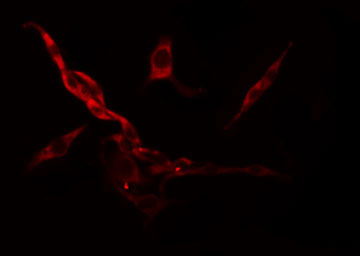 RPS6KC1 Antibody - Staining HeLa cells by IF/ICC. The samples were fixed with PFA and permeabilized in 0.1% Triton X-100, then blocked in 10% serum for 45 min at 25°C. The primary antibody was diluted at 1:200 and incubated with the sample for 1 hour at 37°C. An Alexa Fluor 594 conjugated goat anti-rabbit IgG (H+L) antibody, diluted at 1/600, was used as secondary antibody.