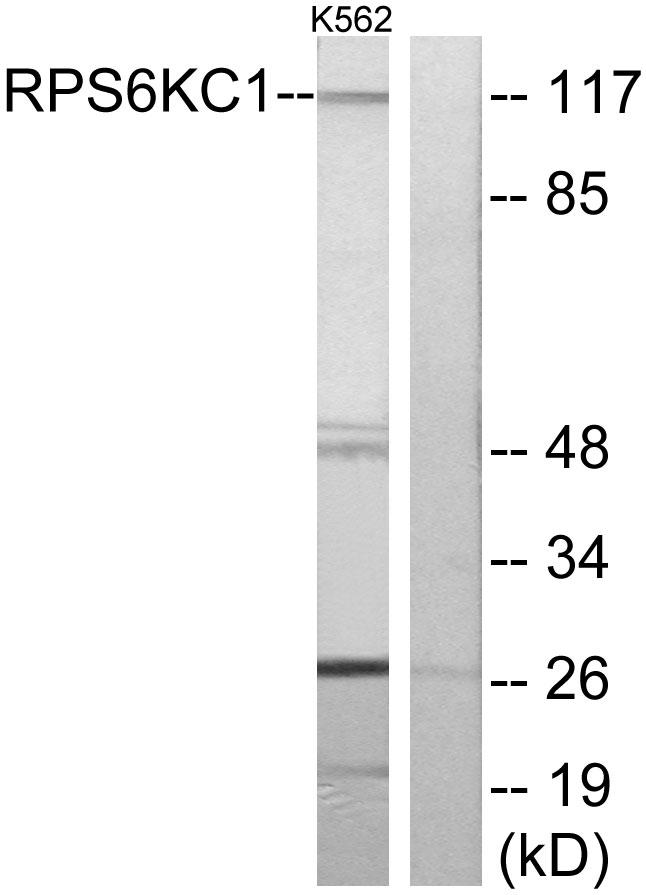 RPS6KC1 Antibody - Western blot analysis of extracts from K562 cells, using RPS6KC1 antibody.