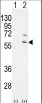 RPS6KL1 Antibody - Western blot of RPS6KL1 (arrow) using rabbit polyclonal RPS6KL1 Antibody. 293 cell lysates (2 ug/lane) either nontransfected (Lane 1) or transiently transfected (Lane 2) with the RPS6KL1 gene.