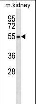 RPS6KL1 Antibody - RPS6KL1 Antibody western blot of mouse kidney tissue lysates (35 ug/lane). The RPS6KL1 antibody detected the RPS6KL1 protein (arrow).