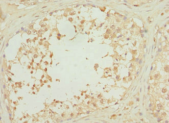 RPS6KL1 Antibody - Immunohistochemistry of paraffin-embedded human testis tissue at dilution 1:100