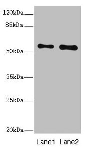 RPS6KL1 Antibody - Western blot All Lanes: RPS6KL1 antibody at 4.02ug/ml Lane 1: Mouse heart tissue Lane 2: Mouse kidney tissue Secondary Goat polyclonal to Rabbit IgG at 1/10000 dilution Predicted band size: 61,60,29 kDa Observed band size: 60 kDa