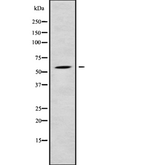 RPS6KL1 Antibody - Western blot analysis of RPS6KL1 using LOVO cells whole cells lysates