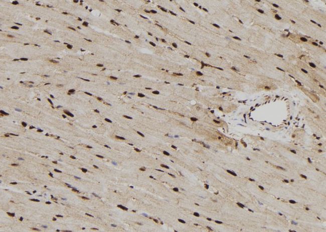 RPS6KL1 Antibody - 1:100 staining rat heart tissue by IHC-P. The sample was formaldehyde fixed and a heat mediated antigen retrieval step in citrate buffer was performed. The sample was then blocked and incubated with the antibody for 1.5 hours at 22°C. An HRP conjugated goat anti-rabbit antibody was used as the secondary.