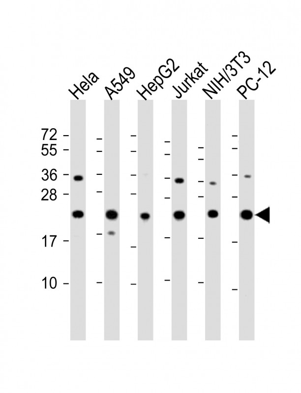 RPS7 / Ribosomal Protein S7 Antibody - All lanes: Anti-RPS7 Antibody (C-Term) at 1:2000 dilution Lane 1: Hela whole cell lysate Lane 2: A549 whole cell lysate Lane 3: HepG2 whole cell lysate Lane 4: Jurkat whole cell lysate Lane 5: NIH/3T3 whole cell lysate Lane 6: PC-12 whole cell lysate Lysates/proteins at 20 µg per lane. Secondary Goat Anti-Rabbit IgG, (H+L), Peroxidase conjugated at 1/10000 dilution. Predicted band size: 22 kDa Blocking/Dilution buffer: 5% NFDM/TBST.