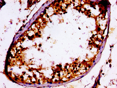 RPS7 / Ribosomal Protein S7 Antibody - Immunohistochemistry image at a dilution of 1:100 and staining in paraffin-embedded human testis tissue performed on a Leica BondTM system. After dewaxing and hydration, antigen retrieval was mediated by high pressure in a citrate buffer (pH 6.0) . Section was blocked with 10% normal goat serum 30min at RT. Then primary antibody (1% BSA) was incubated at 4 °C overnight. The primary is detected by a biotinylated secondary antibody and visualized using an HRP conjugated ABC system.