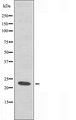 RPS7 / Ribosomal Protein S7 Antibody - Western blot analysis of extracts of JurKat cells using RPS7 antibody.
