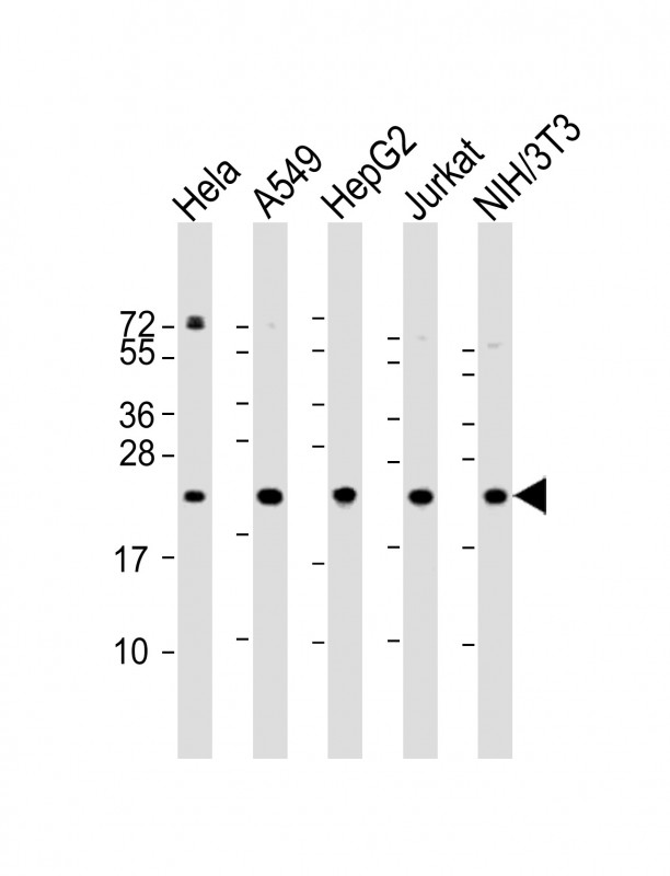 RPS7 / Ribosomal Protein S7 Antibody - All lanes: Anti-RPS7 Antibody (N-Term) at 1:2000 dilution Lane 1: Hela whole cell lysate Lane 2: A549 whole cell lysate Lane 3: HepG2 whole cell lysate Lane 4: Jurkat whole cell lysate Lane 5: NIH/3T3 whole cell lysate Lysates/proteins at 20 µg per lane. Secondary Goat Anti-Rabbit IgG, (H+L), Peroxidase conjugated at 1/10000 dilution. Predicted band size: 22 kDa Blocking/Dilution buffer: 5% NFDM/TBST.