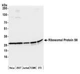 RPS8 / Ribosomal Protein S8 Antibody - Detection of human and mouse Ribosomal Protein S8 by western blot. Samples: Whole cell lysate (50 µg) from HeLa, HEK293T, Jurkat, mouse TCMK-1, and mouse NIH 3T3 cells prepared using NETN lysis buffer. Antibody: Affinity purified rabbit anti-Ribosomal Protein S8 antibody used for WB at 0.1 µg/ml. Detection: Chemiluminescence with an exposure time of 3 seconds.