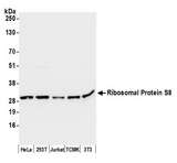 RPS8 / Ribosomal Protein S8 Antibody - Detection of human and mouse Ribosomal Protein S8 by western blot. Samples: Whole cell lysate (50 µg) from HeLa, HEK293T, Jurkat, mouse TCMK-1, and mouse NIH 3T3 cells prepared using NETN lysis buffer. Antibody: Affinity purified rabbit anti-Ribosomal Protein S8 antibody used for WB at 0.1 µg/ml. Detection: Chemiluminescence with an exposure time of 3 seconds.