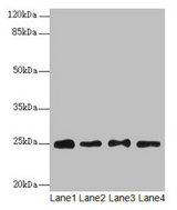 RPS8 / Ribosomal Protein S8 Antibody - Western blot All lanes: RPS8 antibody at 6µg/ml Lane 1: HL60 whole cell lysate Lane 2: THP-1 whole cell lysate Lane 3: 293T whole cell lysate Lane 4: Mouse liver tissue Secondary Goat polyclonal to rabbit IgG at 1/10000 dilution Predicted band size: 24 kDa Observed band size: 24 kDa