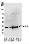 RPS9 /  Ribosomal Protein S9 Antibody - Detection of Human and Mouse RPS9 by Western Blot. Samples: Whole cell lysate from HeLa (15 and 50 ug), 293T (50 ug), Jurkat (50 ug), and mouse NIH3T3 (50 ug) cells. Antibodies: Affinity purified rabbit anti-RPS9 antibody used for WB at 0.4 ug/ml. Detection: Chemiluminescence with an exposure time of 30 seconds.