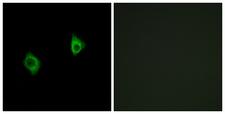 RPS9 /  Ribosomal Protein S9 Antibody - Immunofluorescence analysis of A549 cells, using RPS9 Antibody. The picture on the right is blocked with the synthesized peptide.