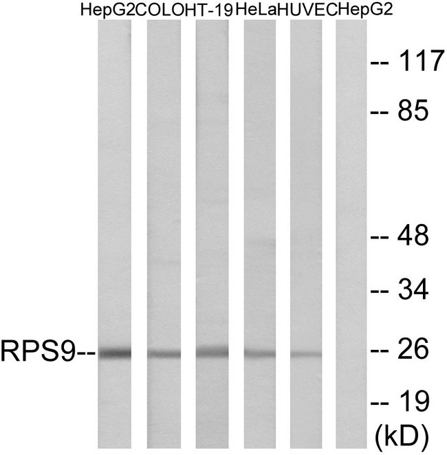 RPS9 /  Ribosomal Protein S9 Antibody - Western blot analysis of lysates from HepG2, COLO, HT-29, HeLa, and HUVEC cells, using RPS9 Antibody. The lane on the right is blocked with the synthesized peptide.