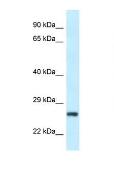 RPS9 /  Ribosomal Protein S9 Antibody - RPS9 antibody western blot of HeLa cell lysate. Antibody concentration 1 ug/ml.  This image was taken for the unconjugated form of this product. Other forms have not been tested.
