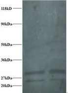 RPS9 /  Ribosomal Protein S9 Antibody - Western blot of 40S ribosomal protein S9 antibody at 2 ug/ml. Lane 1:293T whole cell lysate. Lane 2: EC109 whole cell lysate. Secondary: Goat polyclonal to Rabbit IgG at 1:15000 dilution. Predicted band size: 21 kDa. Observed band size: 26 kDa Additional bands at: 28 kDa. We are unsure as to the identity of these extra bands. 40S ribosomal protein S9 contains a number of potential phosphorylation and acetylation sites (SwissProt) which may explain its migration at a higher molecular weight than predicted.  This image was taken for the unconjugated form of this product. Other forms have not been tested.
