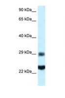 RPS9 /  Ribosomal Protein S9 Antibody - RPS9 antibody Western blot of HepG2 Cell lysate. Antibody concentration 1 ug/ml.  This image was taken for the unconjugated form of this product. Other forms have not been tested.