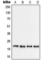 RPS9 /  Ribosomal Protein S9 Antibody - Western blot analysis of RPS9 expression in Jurkat (A); HEK293 (B); HeLa (C); NIH3T3 (D) whole cell lysates.