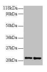RPS9 /  Ribosomal Protein S9 Antibody - Western blot All lanes: 40S ribosomal protein S9 antibody at 2µg/ml Lane 1: 293T whole cell lysate Lane 2: EC109 whole cell lysate Secondary Goat polyclonal to rabbit IgG at 1/15000 dilution Predicted band size: 21 kDa Observed band size: 26 kDa