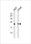 RPS9 /  Ribosomal Protein S9 Antibody - All lanes : Anti-RPS9 Antibody at 1:1000 dilution Lane 1: 293T whole cell lysates Lane 2: Jurkat whole cell lysates Lysates/proteins at 20 ug per lane. Secondary Goat Anti-Rabbit IgG, (H+L),Peroxidase conjugated at 1/10000 dilution Predicted band size : 23 kDa Blocking/Dilution buffer: 5% NFDM/TBST.