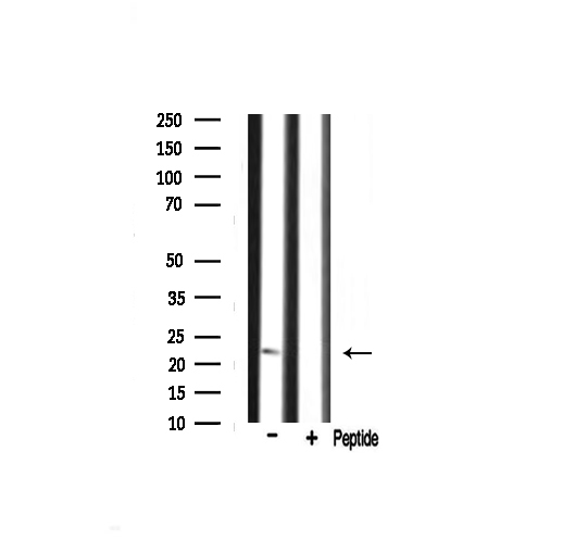 RPS9 /  Ribosomal Protein S9 Antibody - Western blot analysis on mouse liver tissue lysate using RPS9 antibody