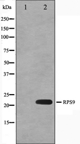 RPS9 /  Ribosomal Protein S9 Antibody - Western blot analysis on HeLa cell lysates using RPS9 antibody. The lane on the left is treated with the antigen-specific peptide.