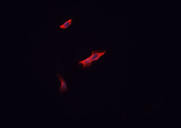 RPS9 /  Ribosomal Protein S9 Antibody - Staining HepG2 cells by IF/ICC. The samples were fixed with PFA and permeabilized in 0.1% Triton X-100, then blocked in 10% serum for 45 min at 25°C. The primary antibody was diluted at 1:200 and incubated with the sample for 1 hour at 37°C. An Alexa Fluor 594 conjugated goat anti-rabbit IgG (H+L) Ab, diluted at 1/600, was used as the secondary antibody.