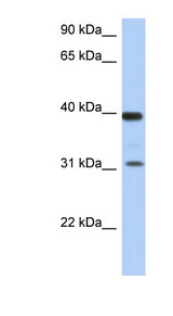 RPSA / Laminin Receptor Antibody - RPSA / Laminin Receptor antibody Western blot of Fetal Thymus lysate. This image was taken for the unconjugated form of this product. Other forms have not been tested.