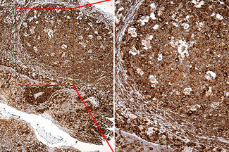 RPSA / Laminin Receptor Antibody - Immunohistochemical staining of paraffin-embedded Human tonsil within the normal limits using anti-RPSA mouse monoclonal antibody. (Heat-induced epitope retrieval by 1mM EDTA in 10mM Tris buffer. (pH8.5) at 120°C for 3 min. (1:2000)