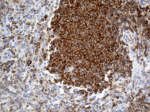 RPSA / Laminin Receptor Antibody - Immunohistochemical staining of paraffin-embedded Human spleen tissue within the normal limits using anti-RPSA mouse monoclonal antibody. (Heat-induced epitope retrieval by 1mM EDTA in 10mM Tris buffer. (pH8.5) at 120°C for 3 min. (1:2000)
