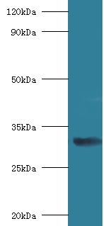RPSA / Laminin Receptor Antibody - Western blot of 40S ribosomal protein SA antibody at 2 ug/ml with mouse small intestine Secondary Goat polyclonal to Rabbit lgG at 1:15000 dilution. Predicted band size: 33 KDa. Observed band size: 33 KDa.  This image was taken for the unconjugated form of this product. Other forms have not been tested.