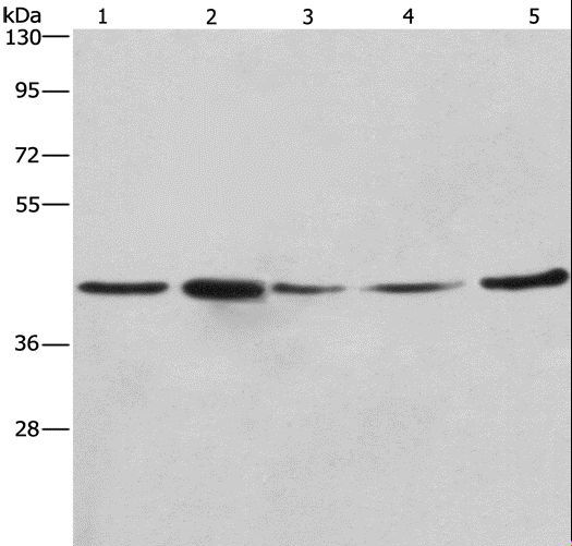 RPSA / Laminin Receptor Antibody - Western blot analysis of A549, NIH/3T3 and 293T cell, human hepatocellular carcinoma tissue and HeLa cell, using RPSA Polyclonal Antibody at dilution of 1:425.