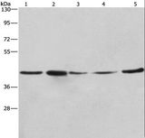RPSA / Laminin Receptor Antibody - Western blot analysis of A549, NIH/3T3 and 293T cell, human hepatocellular carcinoma tissue and HeLa cell, using RPSA Polyclonal Antibody at dilution of 1:425.