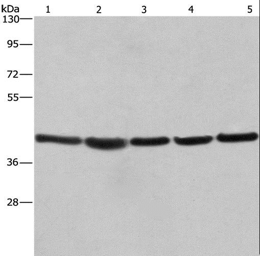 RPSA / Laminin Receptor Antibody - Western blot analysis of A549, NIH/3T3 and 293T cell, human hepatocellular carcinoma tissue and HeLa cell, using RPSA Polyclonal Antibody at dilution of 1:433.3.